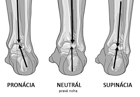 pronated-supinated-diagramoffeet